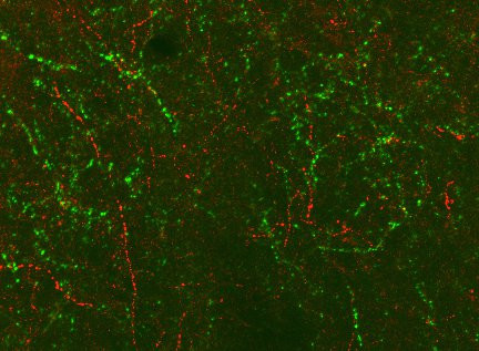 Nociceptin Antibody in Immunocytochemistry (ICC/IF)