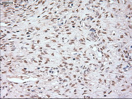 Noggin Antibody in Immunohistochemistry (Paraffin) (IHC (P))