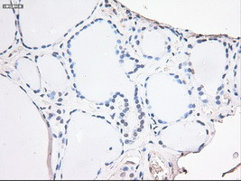 Noggin Antibody in Immunohistochemistry (Paraffin) (IHC (P))