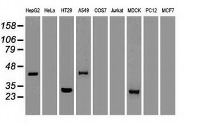 Noggin Antibody in Western Blot (WB)