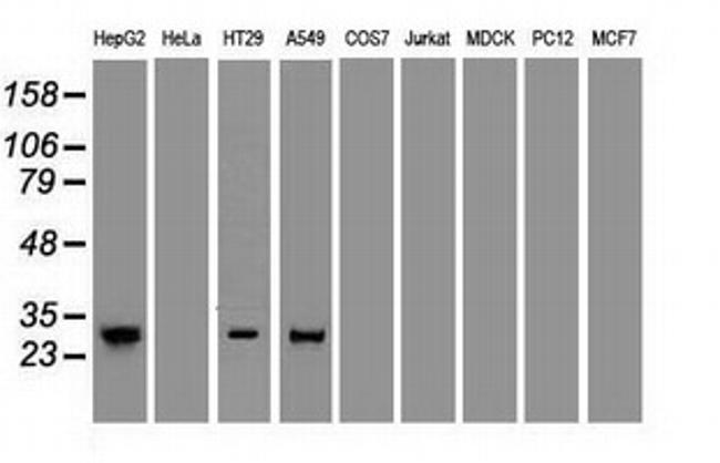 Noggin Antibody in Western Blot (WB)