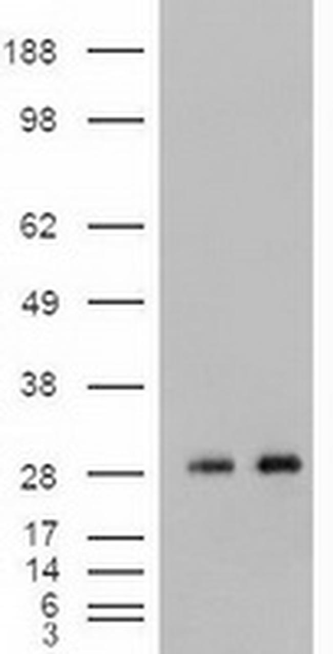 Noggin Antibody in Western Blot (WB)