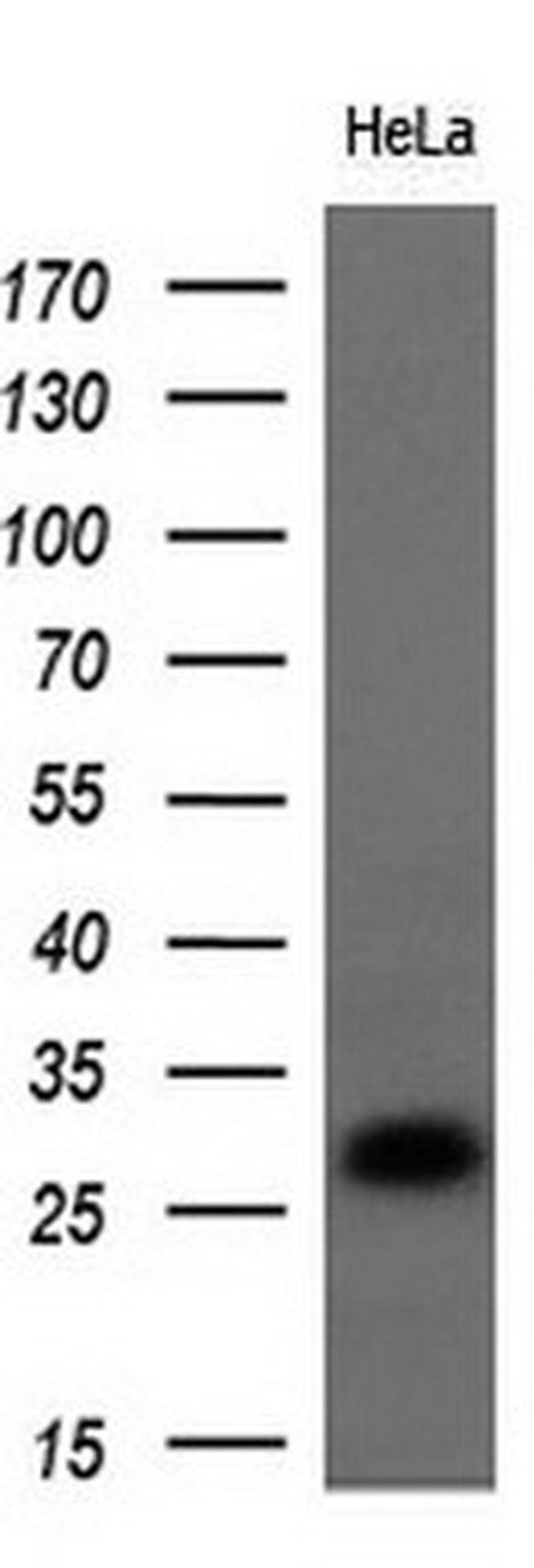 Noggin Antibody in Western Blot (WB)