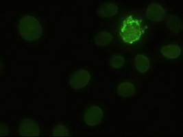 Notch1 Antibody in Immunocytochemistry (ICC/IF)