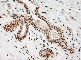 Notch1 Antibody in Immunohistochemistry (Paraffin) (IHC (P))