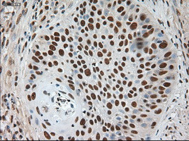 Notch1 Antibody in Immunohistochemistry (Paraffin) (IHC (P))