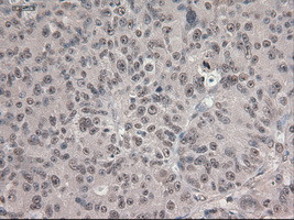 Notch1 Antibody in Immunohistochemistry (Paraffin) (IHC (P))