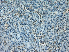 Notch1 Antibody in Immunohistochemistry (Paraffin) (IHC (P))