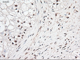 Notch1 Antibody in Immunohistochemistry (Paraffin) (IHC (P))