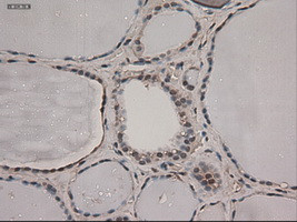 Notch1 Antibody in Immunohistochemistry (Paraffin) (IHC (P))