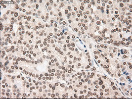 Notch1 Antibody in Immunohistochemistry (Paraffin) (IHC (P))