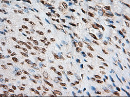 Notch1 Antibody in Immunohistochemistry (Paraffin) (IHC (P))