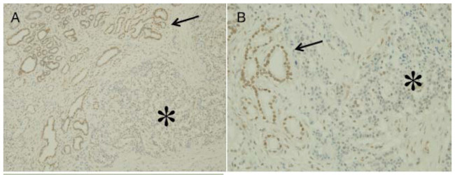 Notch1 Antibody in Immunohistochemistry (Paraffin) (IHC (P))