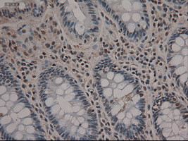 Notch1 Antibody in Immunohistochemistry (Paraffin) (IHC (P))