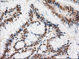 Notch1 Antibody in Immunohistochemistry (Paraffin) (IHC (P))