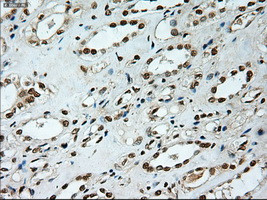 Notch1 Antibody in Immunohistochemistry (Paraffin) (IHC (P))