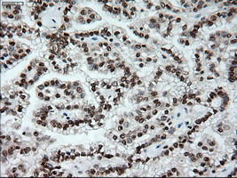 Notch1 Antibody in Immunohistochemistry (Paraffin) (IHC (P))