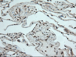 Notch1 Antibody in Immunohistochemistry (Paraffin) (IHC (P))