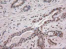 Notch1 Antibody in Immunohistochemistry (Paraffin) (IHC (P))