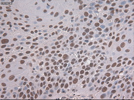 Notch1 Antibody in Immunohistochemistry (Paraffin) (IHC (P))