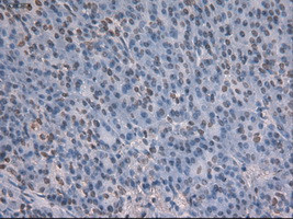 Notch1 Antibody in Immunohistochemistry (Paraffin) (IHC (P))