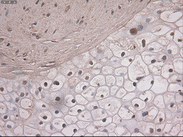 Notch1 Antibody in Immunohistochemistry (Paraffin) (IHC (P))