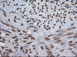 Notch1 Antibody in Immunohistochemistry (Paraffin) (IHC (P))