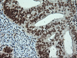 Notch1 Antibody in Immunohistochemistry (Paraffin) (IHC (P))