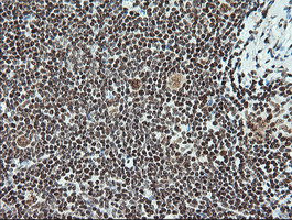 Notch1 Antibody in Immunohistochemistry (Paraffin) (IHC (P))