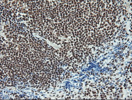 Notch1 Antibody in Immunohistochemistry (Paraffin) (IHC (P))