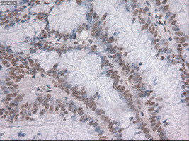 Notch1 Antibody in Immunohistochemistry (Paraffin) (IHC (P))