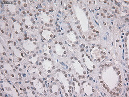 Notch1 Antibody in Immunohistochemistry (Paraffin) (IHC (P))