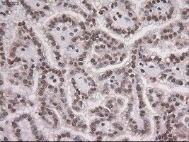 Notch1 Antibody in Immunohistochemistry (Paraffin) (IHC (P))