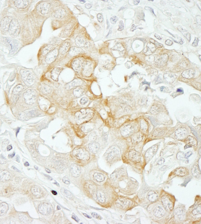 Notch2 Antibody in Immunohistochemistry (IHC)