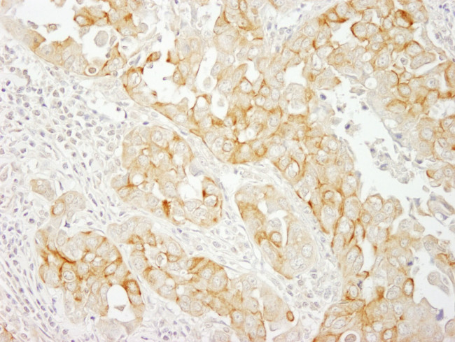 Notch2 Antibody in Immunohistochemistry (IHC)