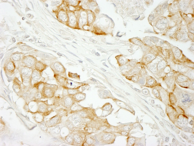 Notch2 Antibody in Immunohistochemistry (IHC)