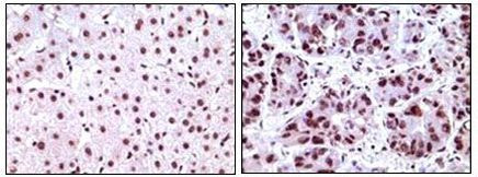 NPM1 Antibody in Immunohistochemistry (Paraffin) (IHC (P))