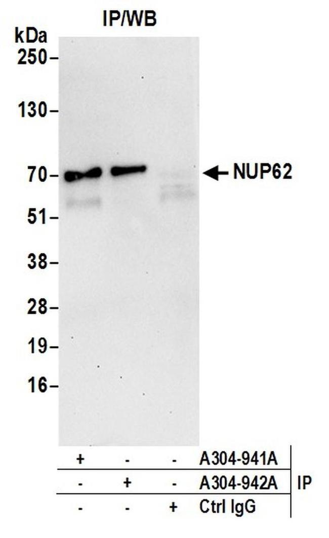 Nucleoporin p62/NUP62 Antibody in Western Blot (WB)