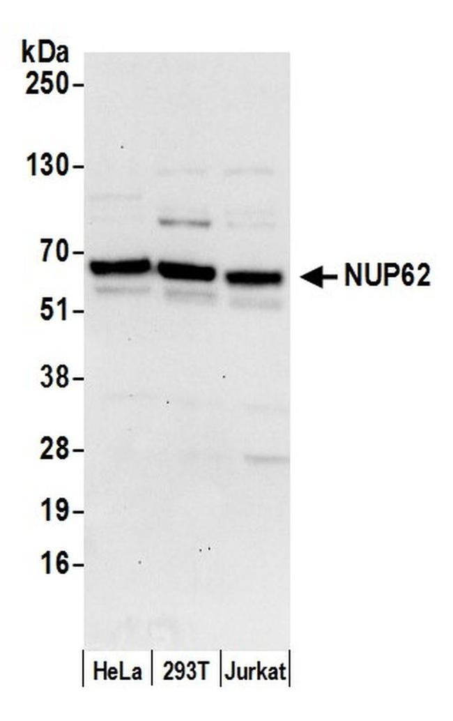 Nucleoporin p62/NUP62 Antibody in Western Blot (WB)