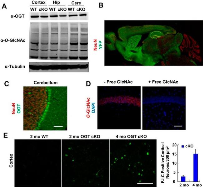 O-linked N-acetylglucosamine (O-GlcNAc) Antibody in Western Blot (WB)