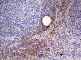 OAS2 Antibody in Immunohistochemistry (Paraffin) (IHC (P))