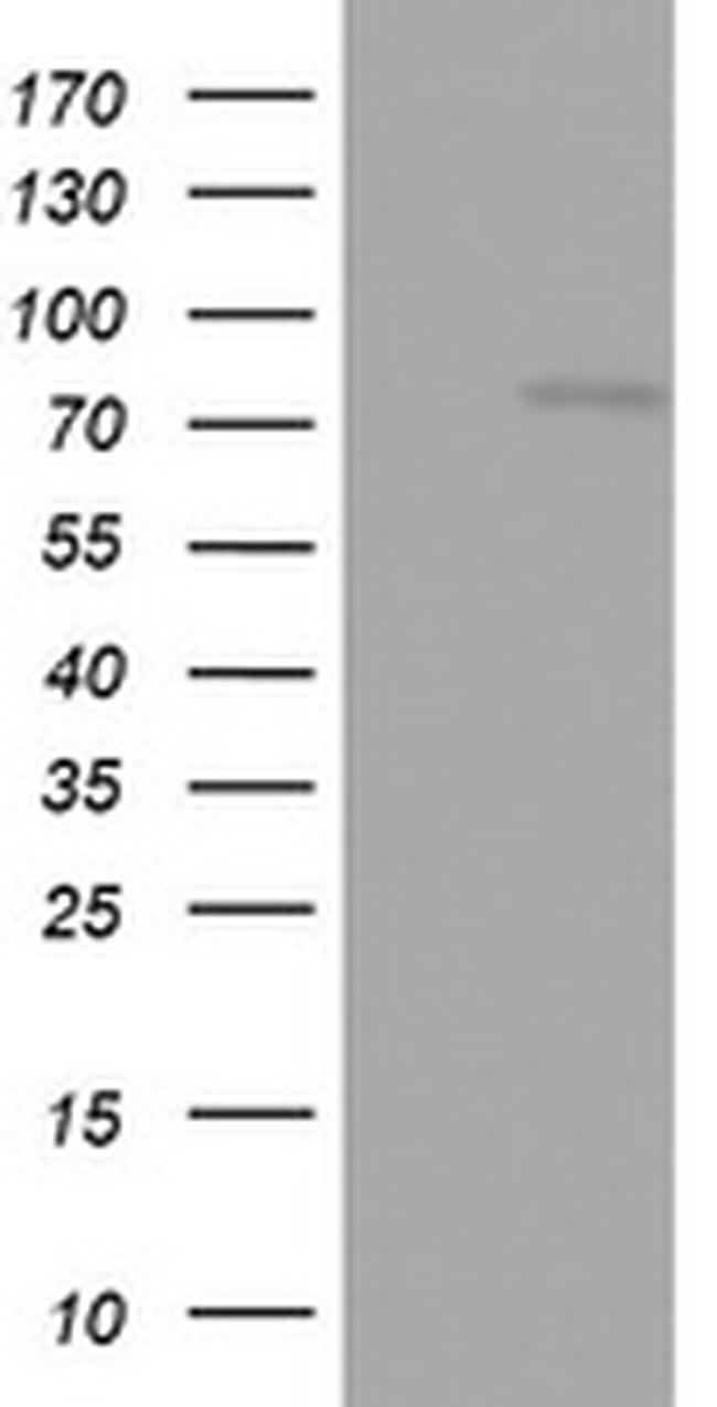 OAS2 Antibody in Western Blot (WB)