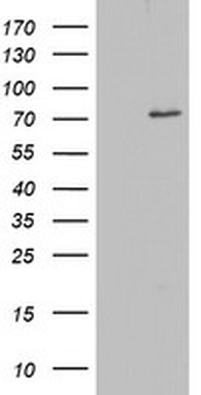 OAS2 Antibody in Western Blot (WB)