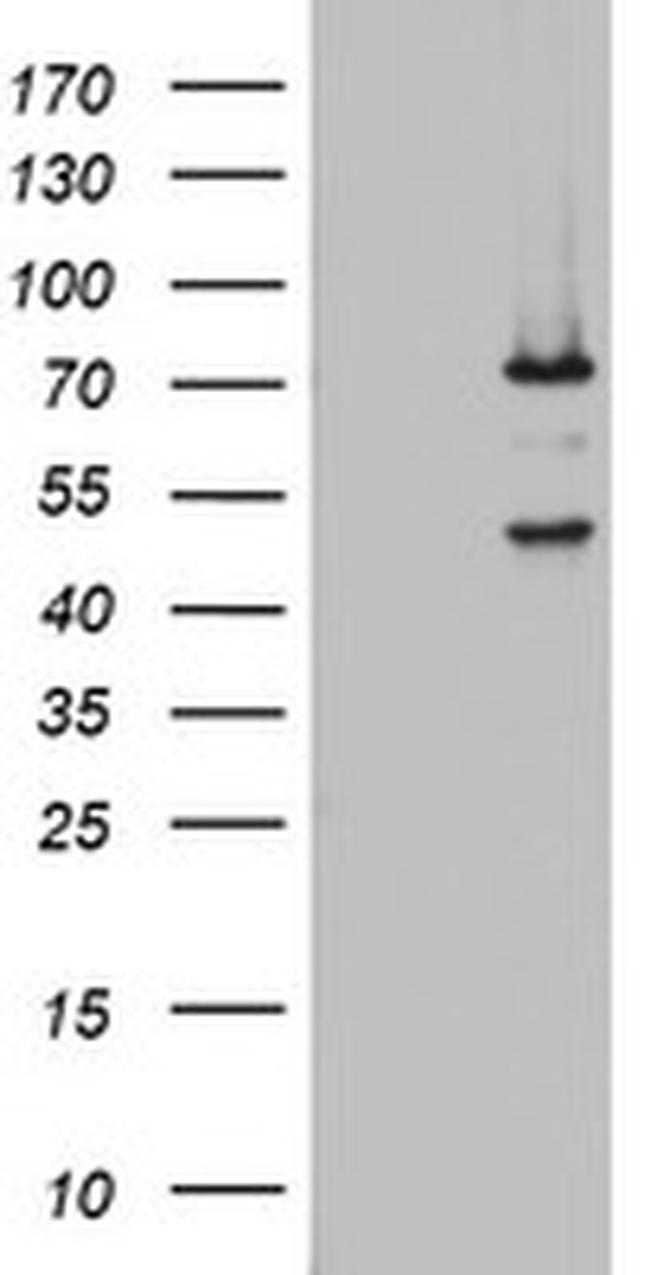 OAS2 Antibody in Western Blot (WB)