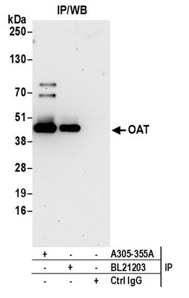 OAT Antibody in Western Blot (WB)