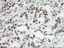 OBFC2B Antibody in Immunohistochemistry (Paraffin) (IHC (P))