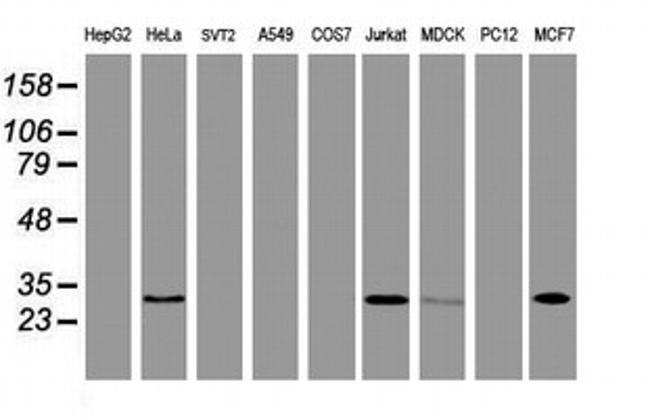 OBFC2B Antibody in Western Blot (WB)