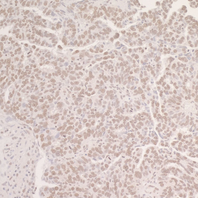 OCT1 Antibody in Immunohistochemistry (IHC)