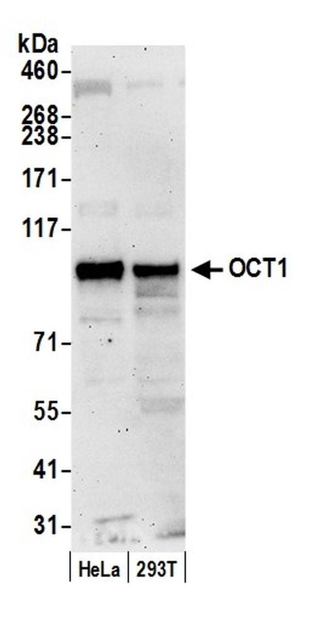 OCT1 Antibody in Western Blot (WB)