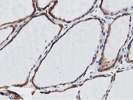 OGFOD1 Antibody in Immunohistochemistry (Paraffin) (IHC (P))